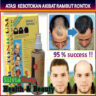 Foto: Hair Tonic Atasi Rambut  Botak Dan Rontok